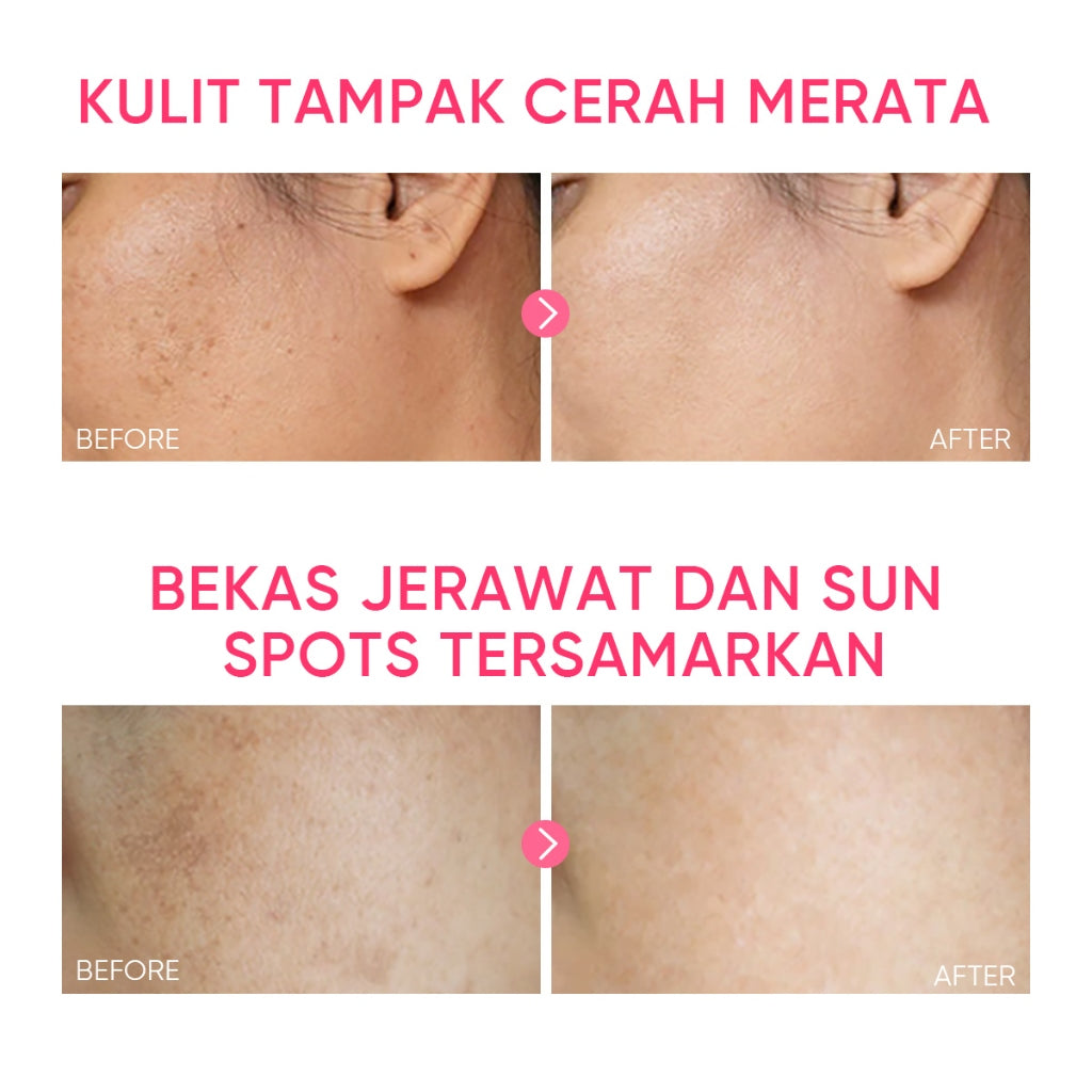 SKINTIFIC Niacinamide whitening moisturizer for face anti dark spot remover brightening skincare 30g