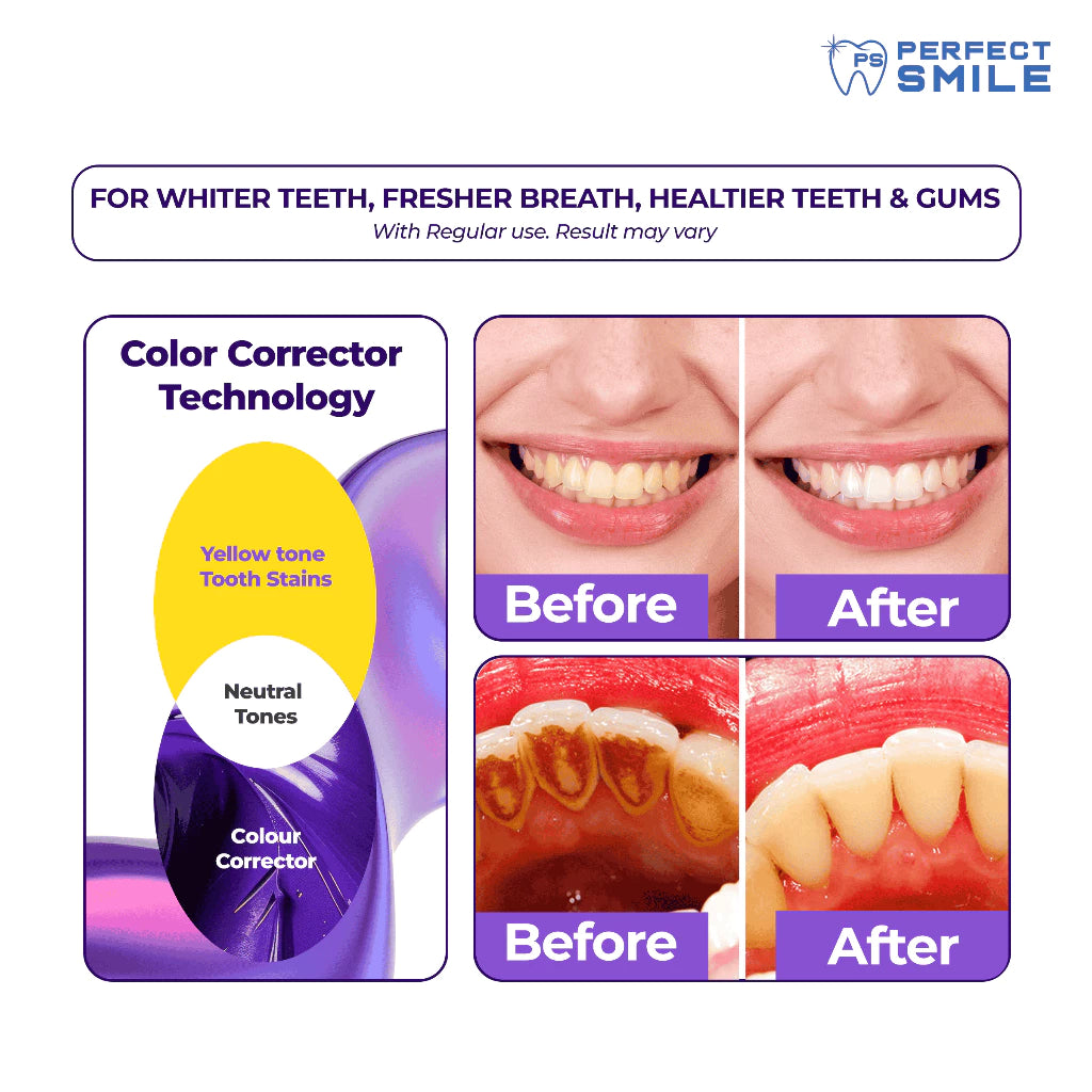 Perfect Smile Purple White Stain Removing Toothpaste 100ml Value Pack 2pcs