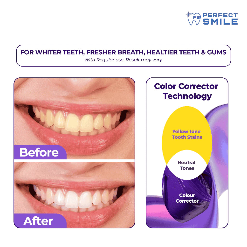 Perfect Smile Purple White Stain Removing Toothpaste 100ml Value Pack 2pcs