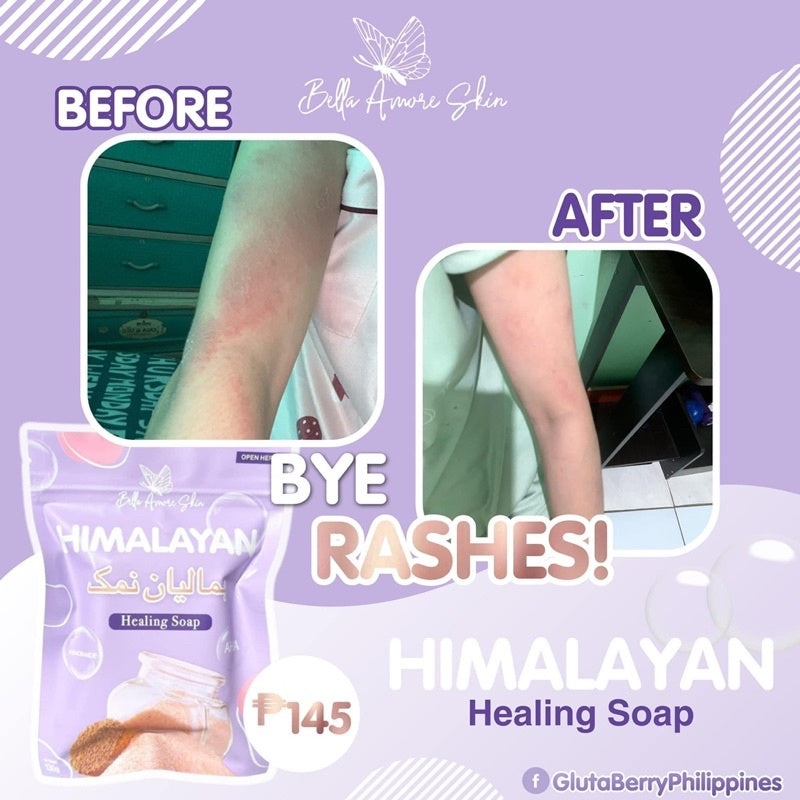 Bella Amore Skin - Himalayan Brightening Soap
