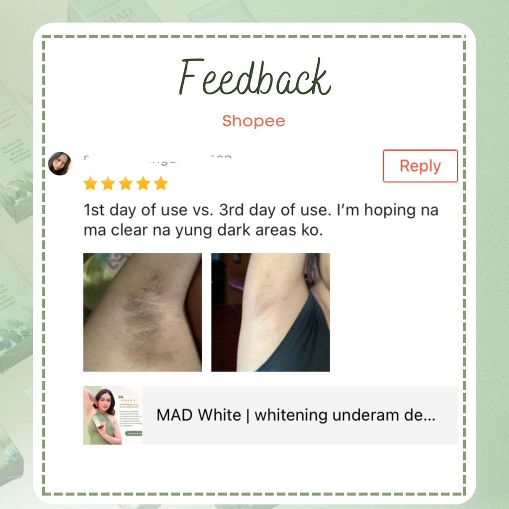 MAD White Whitening Underarm Deo Cream Chicken skin Exfoliating Moisturizing