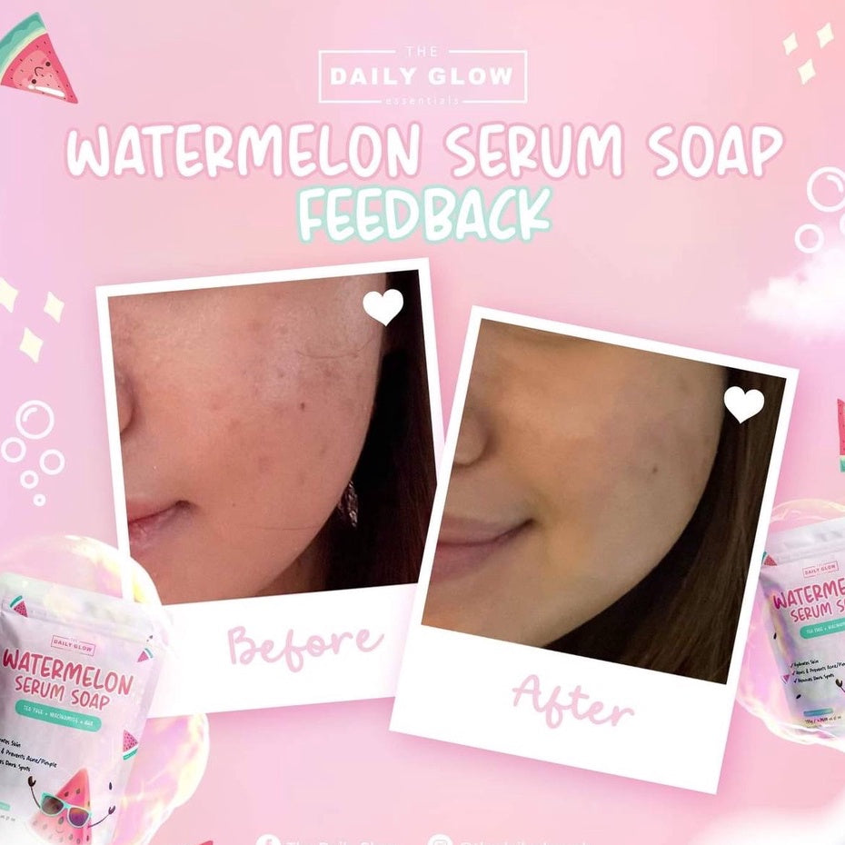 The Daily Glow Watermelon Serum Soap