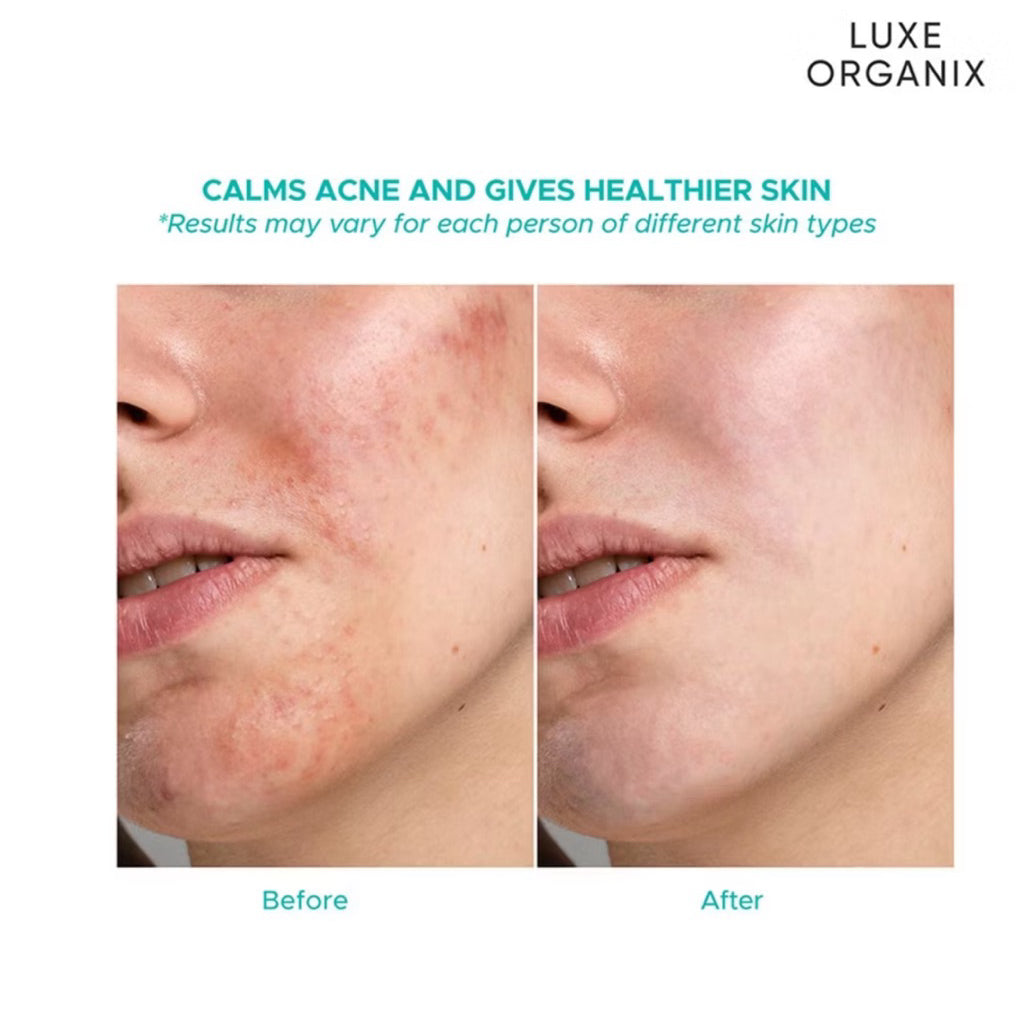 Luxe Organix Miracle Solutions Aha/Bha Emulsion 80mL