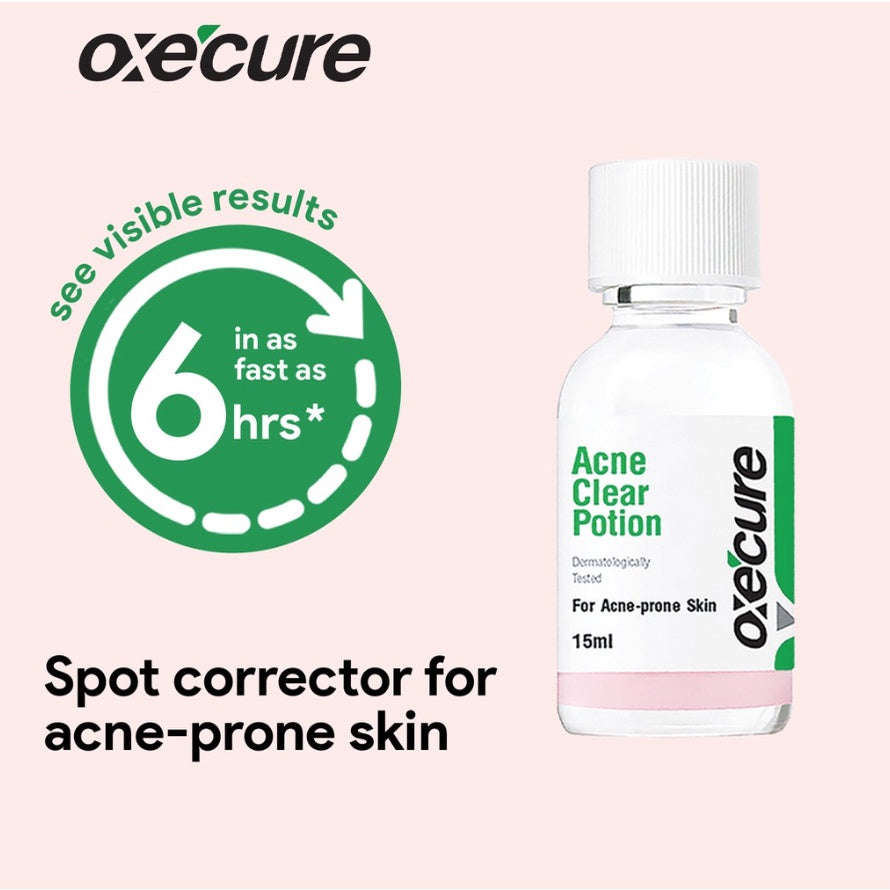 Oxecure Acne Clear Potion 15ml