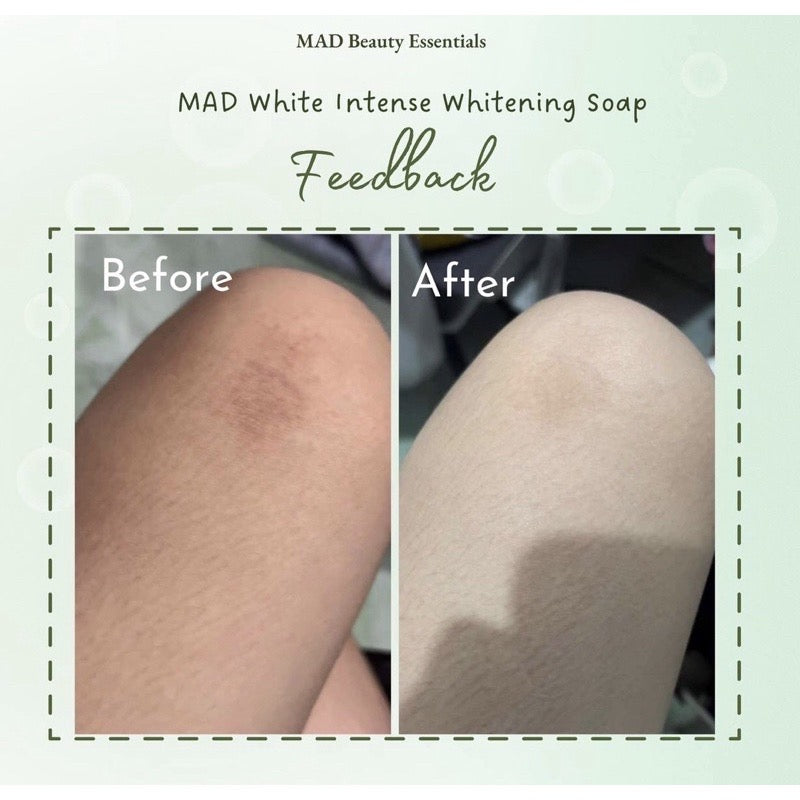 MAD White Intense Whitening Soap for Face and Body