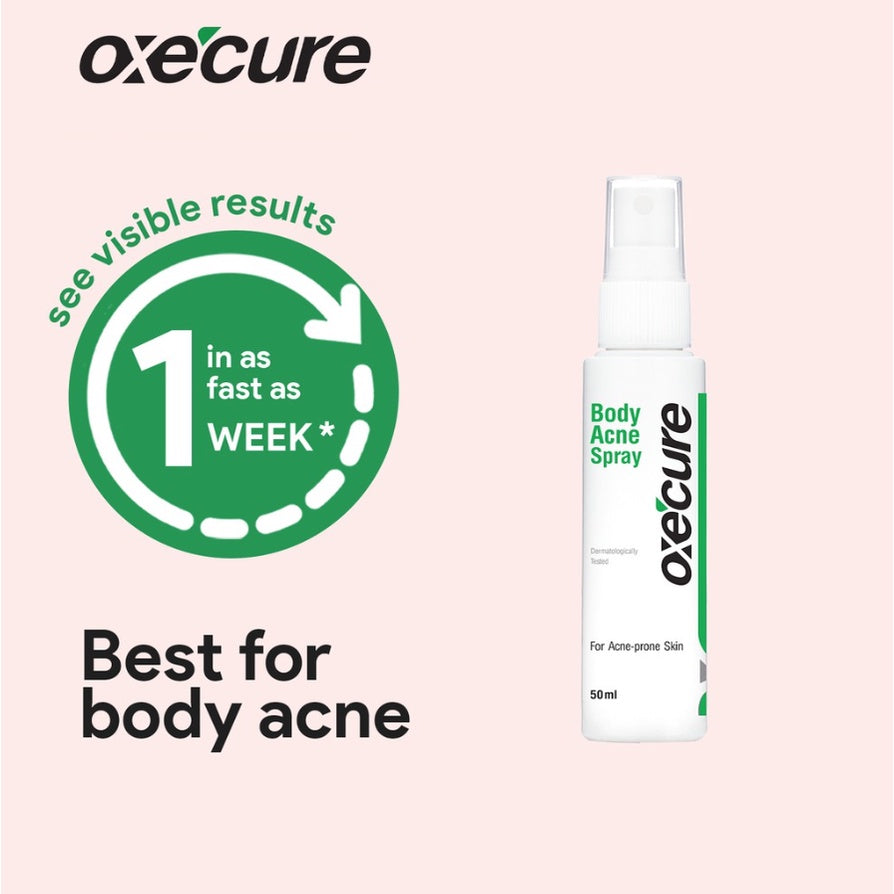 Oxecure Body Acne Spray 50ml