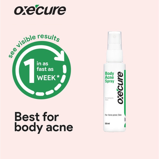 Oxecure Body Acne Spray 50ml